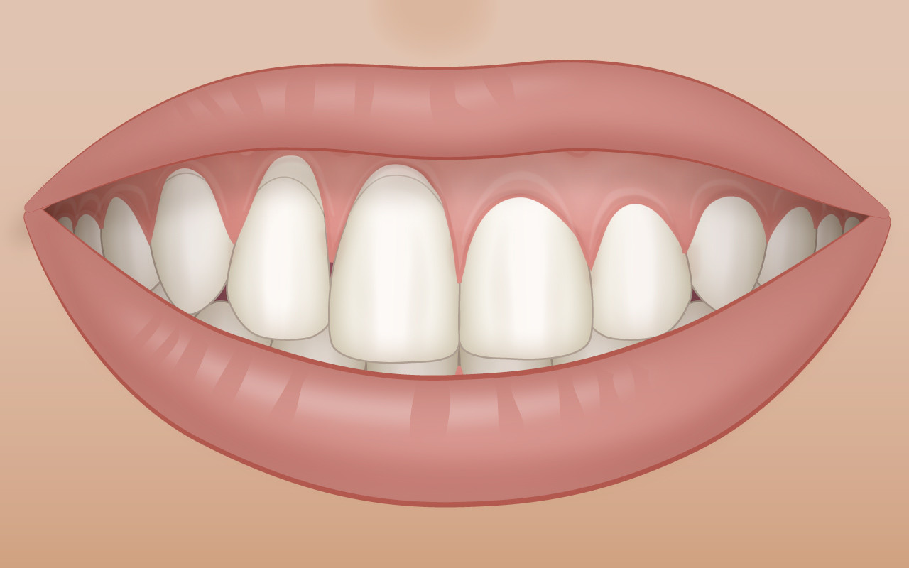 Probleme mit dem Aussehen (Ästhetik)