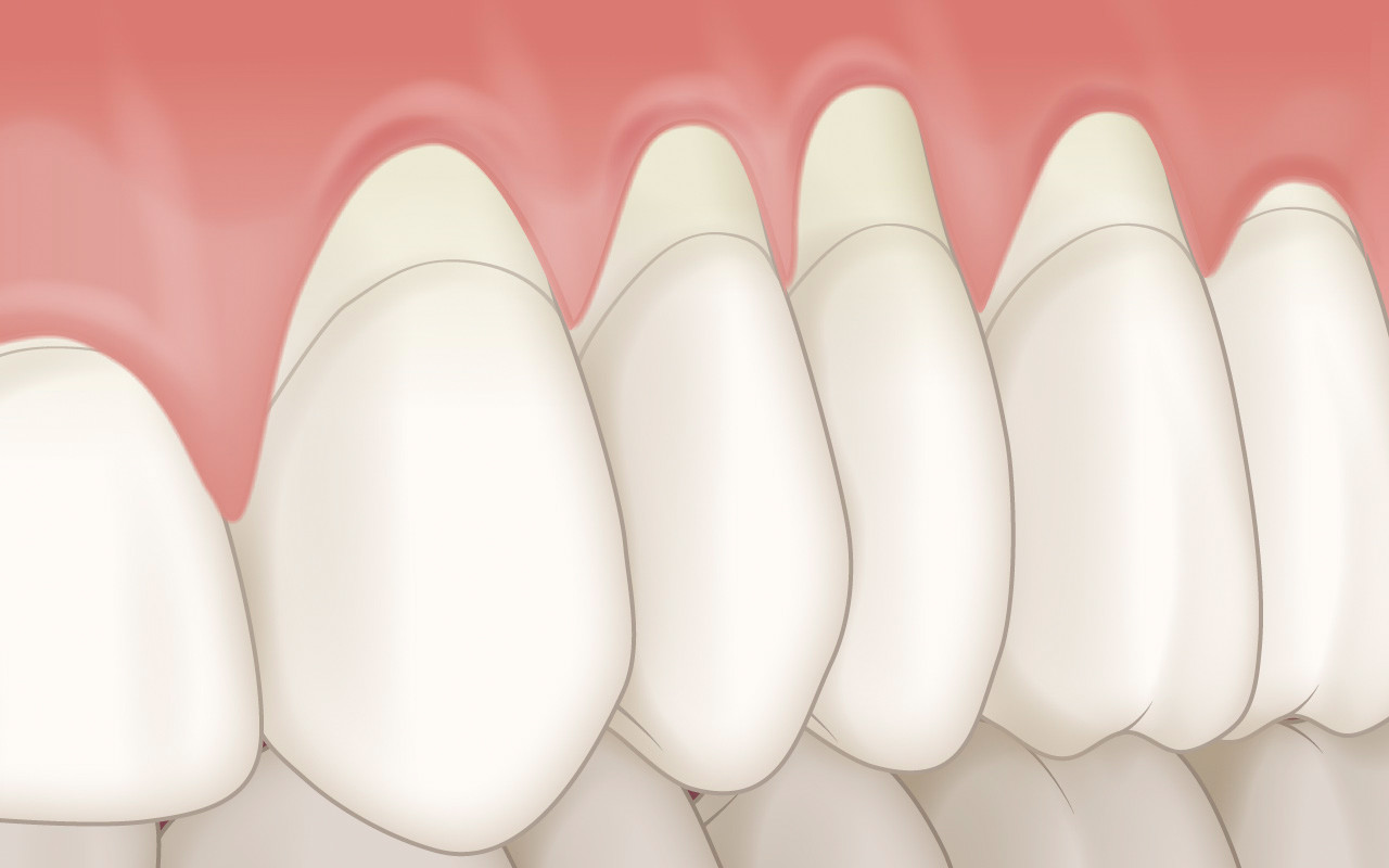 Klinische Untersuchung